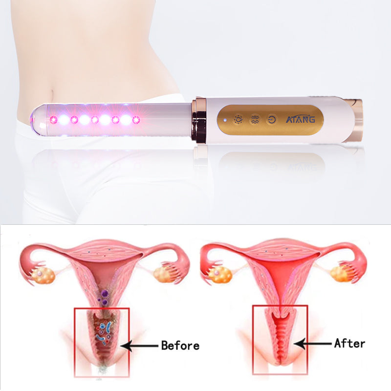 Home Cervical Erosion Cold Laser Therapy Supports Vaginal Tightening Vaginitis Daily Care