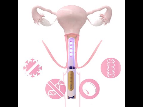 Vaginitis & Dryness Relief Cold Laser Therapy Device for Yeast Infection Relief (Women’s Care)