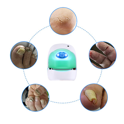 Onychomycosis Treatment Nail Fungus Laser For Ingrown Toenail Treatment