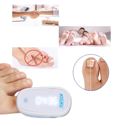 Onychomycosis Treatment Nail Fungus Laser For Ingrown Toenail Treatment