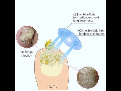 Toenail Fungus Laser Treatment At-Home Fast-Acting Onychomycosis Relief Device